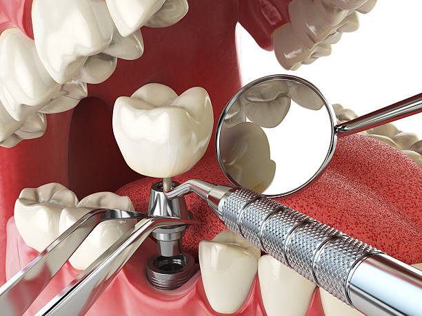Best Emergency Dental Care for Sports Injuries in Weldon, CA